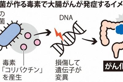 要介護認定:要介護更新通知、6市廃止 政令市・中核市 失効の恐れ 毎日新聞調査